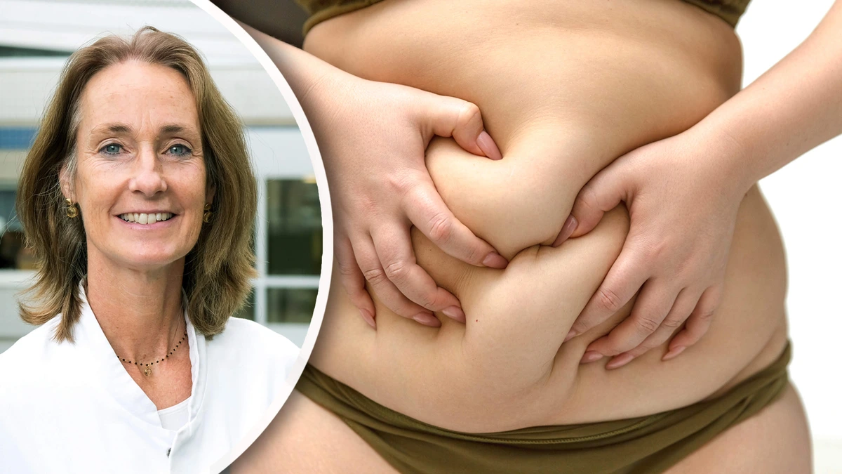 Experts verbaasd over vergoeding voor maagverkleining tieners met obesitas: ’Afslankmedicatie lijkt me eerste stap’