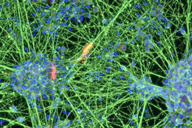 Vecchie cellule del sangue trasformate in giovani neuroni