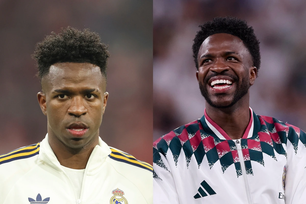 La nueva imagen de Vinicius: "Es el tratamiento que se hacen los hombres cuando quieren lucir más potentes desde la masculinidad"